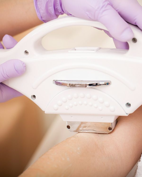 Skin care. Hands Laser epilation and cosmetology. Hair removal cosmetology procedure.